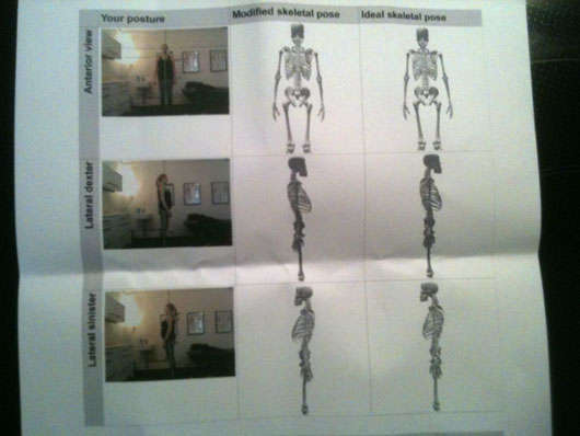 Det är jag på fotona samt skelettbilderna i mittersta kolumnen. Till höger är referensskelettet.